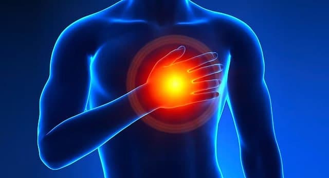 Understanding Angina: Causes, Symptoms, and Treatment